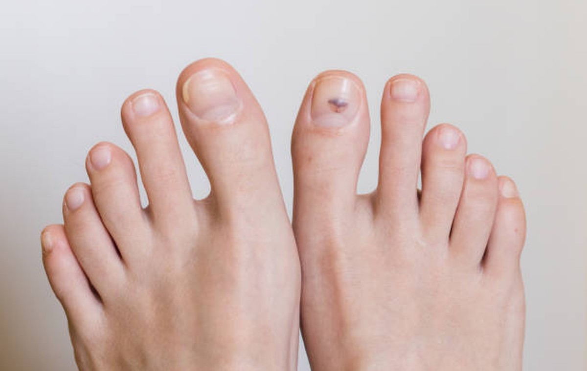 Foot Health