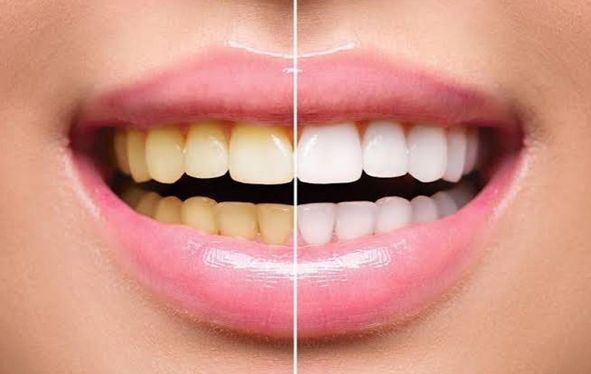 Smile Care